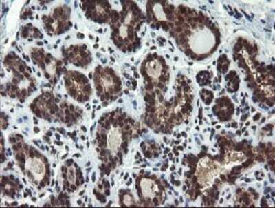 Immunohistochemistry: Phosphoribosyl Pyrophosphate Amidotransferase Antibody (OTI1B11) [NBP2-45379]