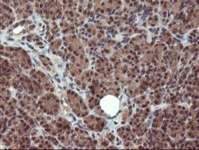 Immunohistochemistry: Phosphoribosyl Pyrophosphate Amidotransferase Antibody (OTI1B11) [NBP2-45379]