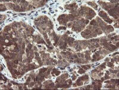 Immunohistochemistry: Phosphoribosyl Pyrophosphate Amidotransferase Antibody (OTI1B11) [NBP2-45379]