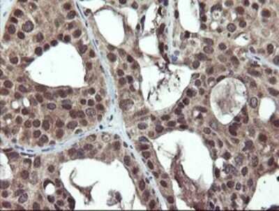 Immunohistochemistry: Phosphoribosyl Pyrophosphate Amidotransferase Antibody (OTI1B11) [NBP2-45379]