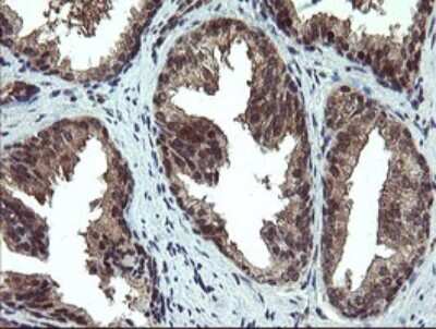 Immunohistochemistry: Phosphoribosyl Pyrophosphate Amidotransferase Antibody (OTI1B11) [NBP2-45379]