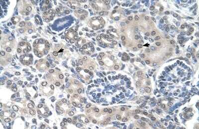 Immunohistochemistry-Paraffin: Phosphoribosyl Pyrophosphate Amidotransferase Antibody [NBP1-52964]