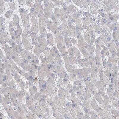 Immunohistochemistry-Paraffin: Phosphoribosyl Pyrophosphate Amidotransferase Antibody [NBP1-89744]