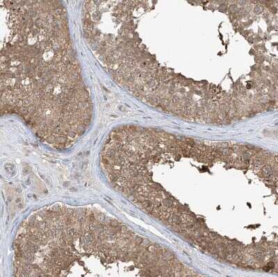Immunohistochemistry-Paraffin: Phosphoribosyl Pyrophosphate Amidotransferase Antibody [NBP1-89744]