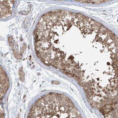 Immunohistochemistry-Paraffin: Phosphoribosyl Pyrophosphate Amidotransferase Antibody [NBP2-38279]