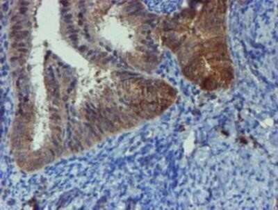 Immunohistochemistry: Phosphoribosyl Pyrophosphate Amidotransferase Antibody (OTI1B8) - Azide and BSA Free [NBP2-73394]