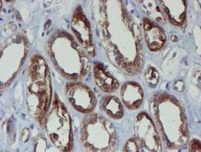 Immunohistochemistry: Phosphoribosyl Pyrophosphate Amidotransferase Antibody (OTI1B8) - Azide and BSA Free [NBP2-73394]