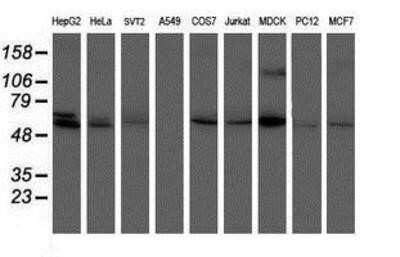 Western Blot: Phosphoribosyl Pyrophosphate Amidotransferase Antibody (OTI1B8)Azide and BSA Free [NBP2-73394]