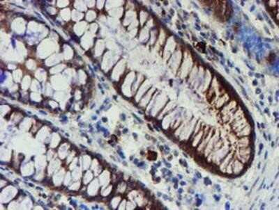 Immunohistochemistry-Paraffin: Phosphoribosyl Pyrophosphate Amidotransferase Antibody (OTI1B8) [NBP2-02056]