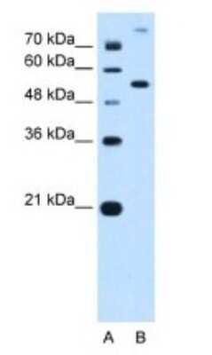 Western Blot: Phosphoribosyl Pyrophosphate Amidotransferase Antibody [NBP1-52964]