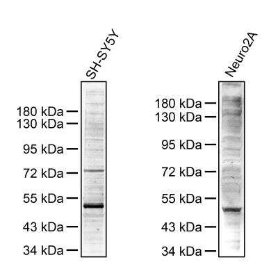 Western Blot: Phosphoserine Antibody [NB100-1953]