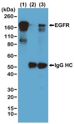 Immunoprecipitation: Phospho-Tyrosine Antibody (RM111) [NBP2-77400]