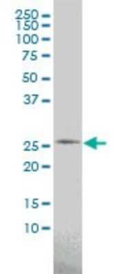 Western Blot: Phosphoserine phosphatase Antibody (2G9) [H00005723-M02]