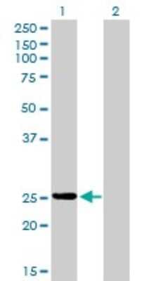 Western Blot: Phosphoserine phosphatase Antibody (2G9) [H00005723-M02]