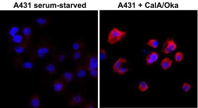 Immunocytochemistry/ Immunofluorescence: Phosphothreonine Antibody (RM102) [NBP2-77398]