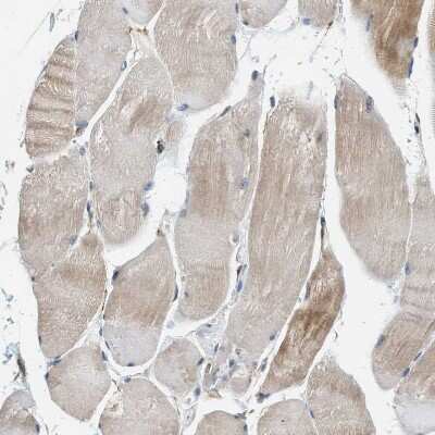 Immunohistochemistry-Paraffin: Piccolo Antibody [NBP1-90251]