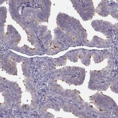 Immunocytochemistry/ Immunofluorescence: Pierce-1 Antibody [NBP2-68830]