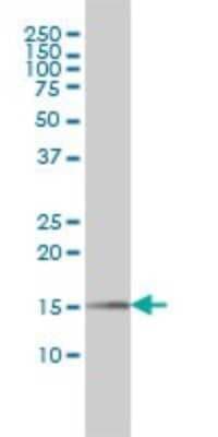 Western Blot: Pin1 Antibody (2F2) [H00005300-M01]