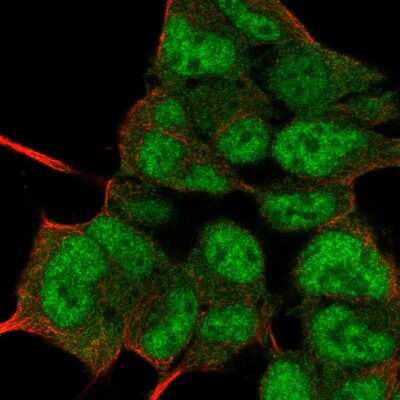 Immunocytochemistry/ Immunofluorescence: Pin1 Antibody [NBP2-55706]