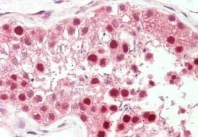 Immunohistochemistry: Pin1 Antibody [NBP1-77757]