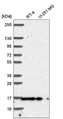 Western Blot: Pin1 Antibody [NBP2-55706]