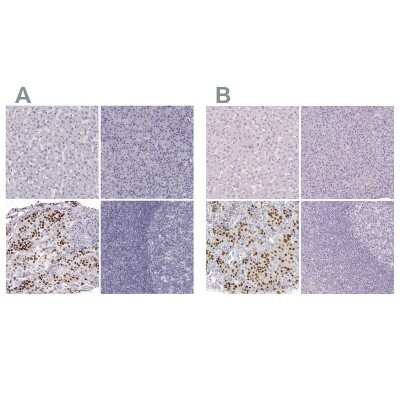 Immunohistochemistry-Paraffin: Pit1 Antibody [NBP1-92273]