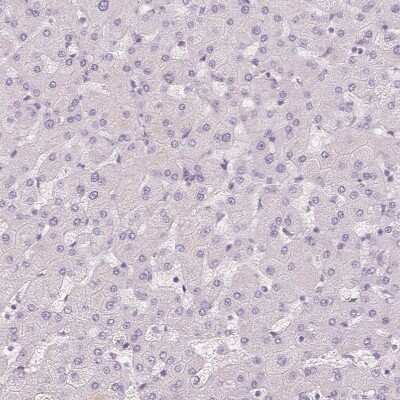 Immunohistochemistry-Paraffin: Pit1 Antibody [NBP2-55357]