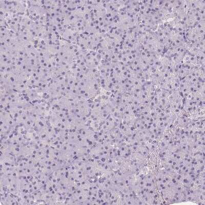 Immunohistochemistry-Paraffin: Pit1 Antibody [NBP2-55357]