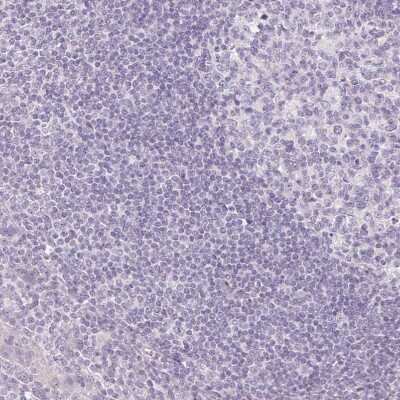Immunohistochemistry-Paraffin: Pit1 Antibody [NBP2-55357]