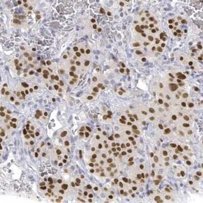 Immunohistochemistry-Paraffin: Pit1 Antibody [NBP2-55357]