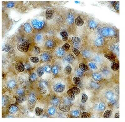 Immunohistochemistry-Paraffin: Pit1 Antibody [NBP2-85477]