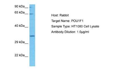 Western Blot: Pit1 Antibody [NBP2-85477]