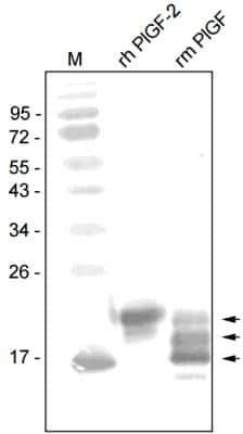 Western Blot: PLGF Antibody [NB600-1012]