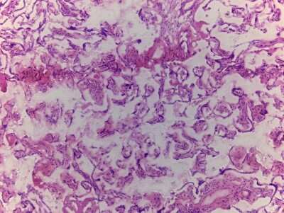 Hematoxylin & Eosin Stain: Placenta Tissue Slides (Adult Normal)- Frozen [NBP2-77554]