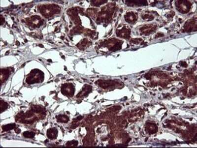 Immunohistochemistry: Placental Lactogen/CSH1 Antibody (OTI2G4) [NBP2-46376]