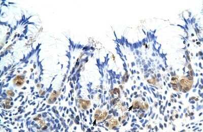 Immunohistochemistry-Paraffin: Placental Lactogen/CSH1 Antibody [NBP1-59302]