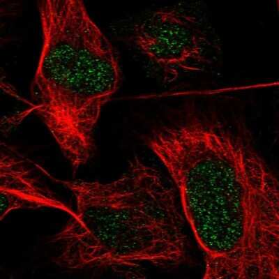 Immunocytochemistry/ Immunofluorescence: Plakophilin 1 Antibody [NBP1-90041]