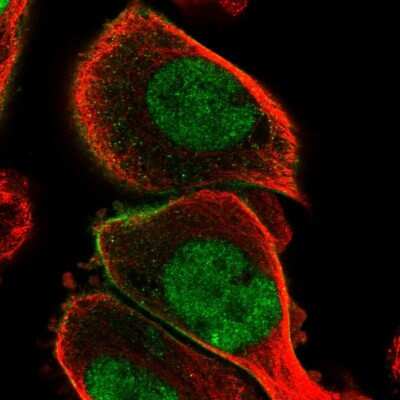 Immunocytochemistry/ Immunofluorescence: Plakophilin 1 Antibody [NBP1-90042]
