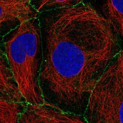Immunocytochemistry/ Immunofluorescence: Plakophilin 2 Antibody [NBP2-58748]