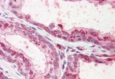 Immunohistochemistry-Paraffin: Plakophilin 2 Antibody [NBP1-72054]
