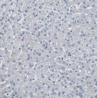 Immunohistochemistry-Paraffin: Plakophilin 2 Antibody [NBP1-86078]