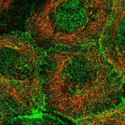 Immunocytochemistry/ Immunofluorescence: Plakophilin-3 Antibody [NBP2-49379]