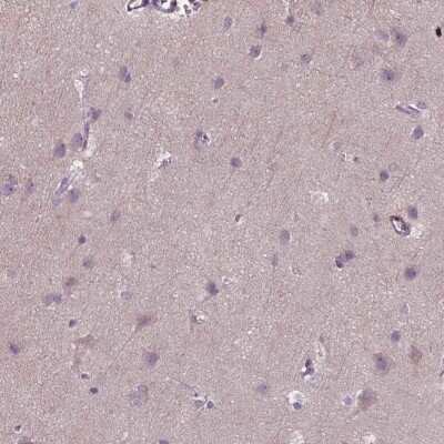 Immunohistochemistry-Paraffin: Plakophilin-3 Antibody [NBP2-49379]