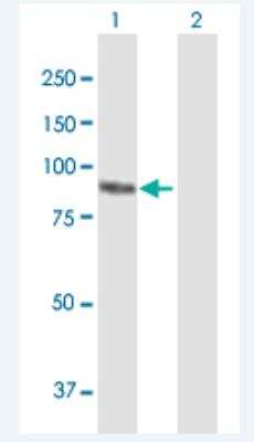 Western Blot: Plakophilin-3 Antibody [H00011187-B01P-50ug]