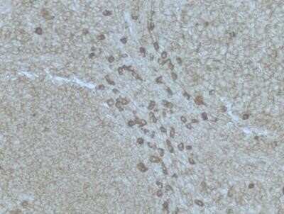 Immunohistochemistry-Paraffin: Plasma Cell Marker Antibody (SPM310) - Azide and BSA Free [NBP2-34407]