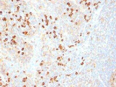 Immunohistochemistry-Paraffin: Plasma Cell Marker Antibody (SPM310) [NBP2-34359]