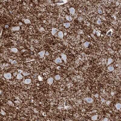 Immunohistochemistry-Paraffin: Plasmolipin Antibody [NBP2-13777]