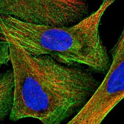 Immunocytochemistry/ Immunofluorescence: Plastin L Antibody [NBP1-88057]
