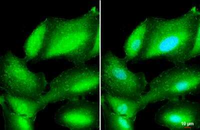 Immunocytochemistry/ Immunofluorescence: Plastin L Antibody [NBP2-19860]