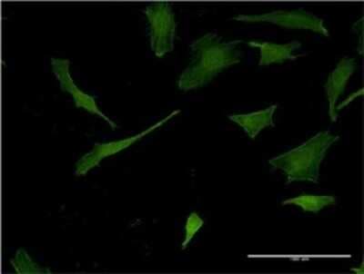 Immunocytochemistry/ Immunofluorescence: Pleckstrin Antibody (2D8) [H00005341-M03]